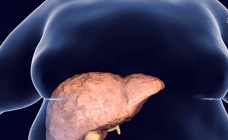 ঘরে বসে লিভার সমস্যা বোঝার উপায়