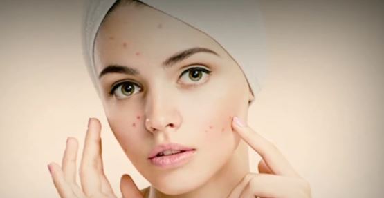 বয়স বাড়লেও সৌন্দর্য থাকুক অটুট